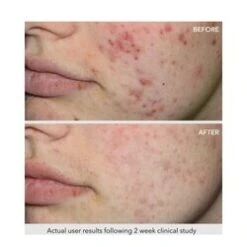 QuasarMD Clear Rayz - White -Eskinstore Sales Store Clear Rayz White add3 34621 3948 general