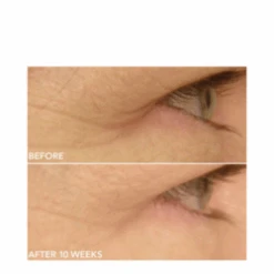 Dr Dennis Gross DRx SpectraLite EyeCare Max Pro -Eskinstore Sales Store DRx SpectraLite EyeCare Max Pro add11 55581 8703 general