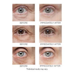 Peter Thomas Roth Instant FirmX -Eskinstore Sales Store Instant FirmX add3 20320 7801 general